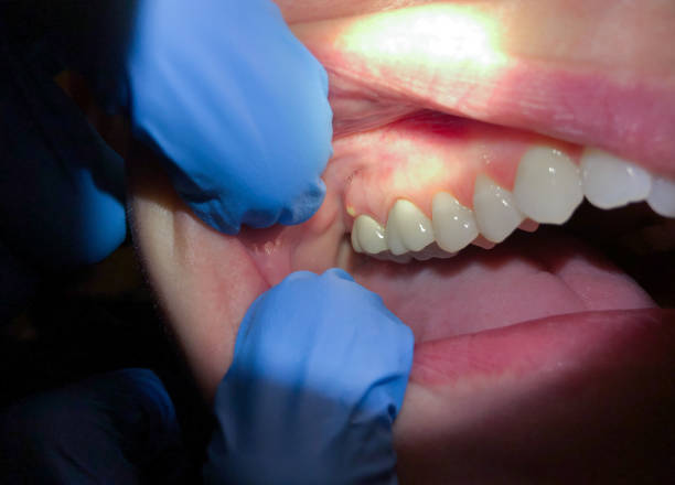 Best Emergency Dentist for Knocked-Out Tooth in Freedom, CA