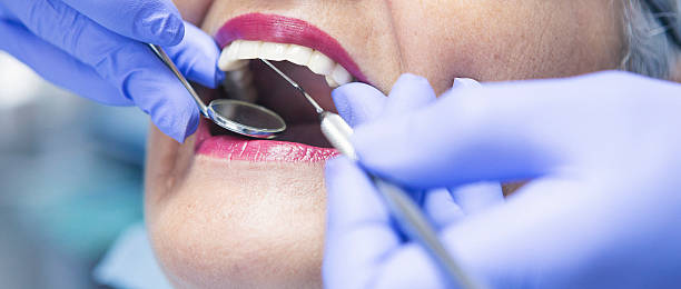 Best Broken or Cracked Tooth Emergency Dentist in Freedom, CA